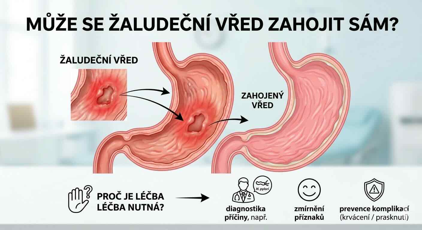 Může se žaludeční vřed zahojit sám?