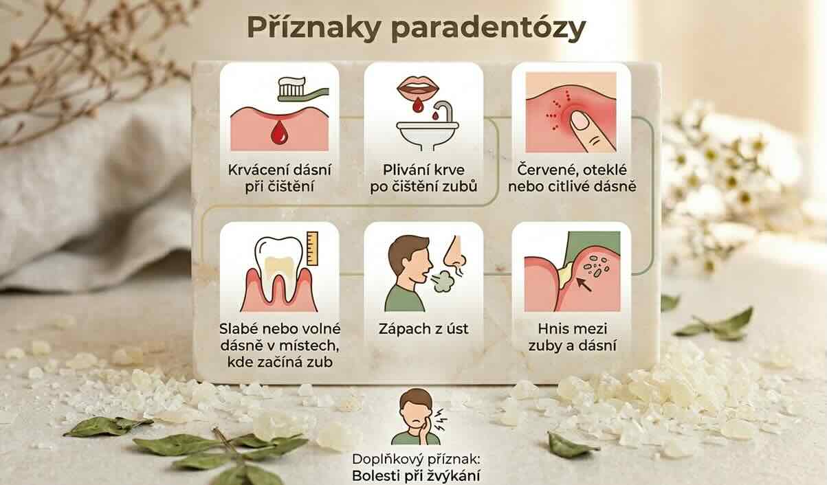 Parodontitida (paradentóza)je zánětlivé onemocnění postihující závěsný aparát zubu.